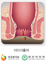 치열 이미지