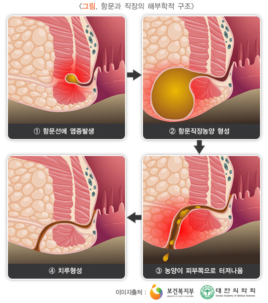 항문과 직장의 해부학적 구조